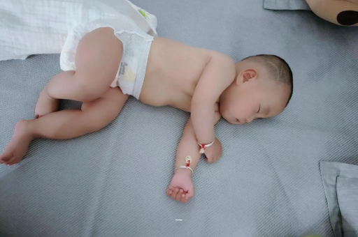 岳阳宝宝脸上有白色斑块